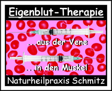 Immunstimulation durch Eigenblut-Inektionen